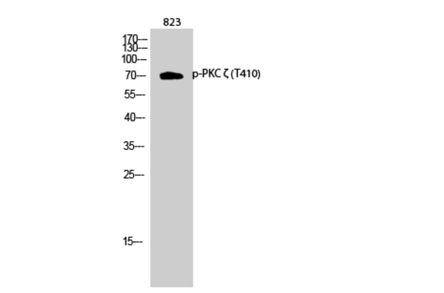 Western Blot - Anti-PKC zeta (phospho Thr410) Antibody (A0023) - Antibodies.com