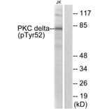 Western Blot - Anti-PKC delta (phospho Tyr52) Antibody (A0801) - Antibodies.com