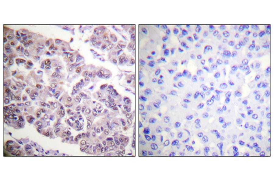 Immunohistochemistry - Anti-Histone H4 (acetyl Lys12) Antibody (D0013) - Antibodies.com
