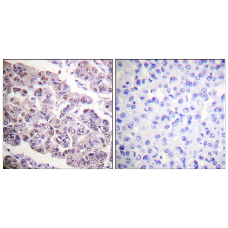 Immunohistochemistry - Anti-Histone H4 (acetyl Lys12) Antibody (D0013) - Antibodies.com