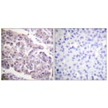 Immunohistochemistry - Anti-Histone H4 (acetyl Lys12) Antibody (D0013) - Antibodies.com