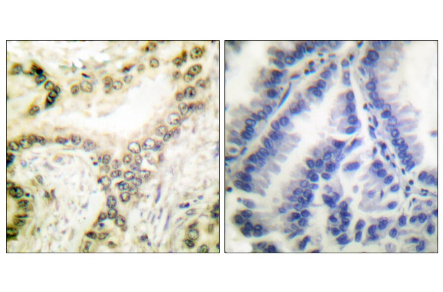 Immunohistochemistry - Anti-Histone H3 (acetyl Lys18) Antibody (D0008) - Antibodies.com