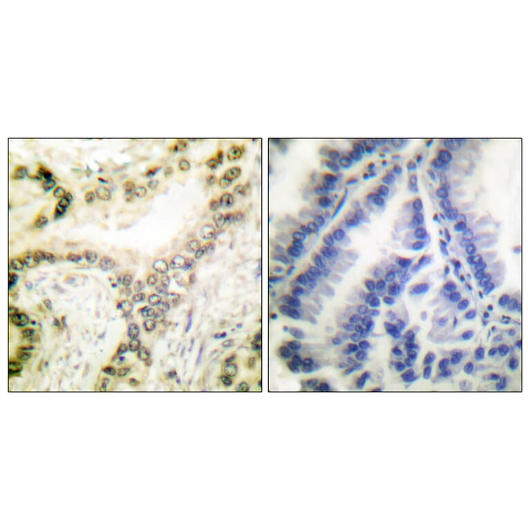 Immunohistochemistry - Anti-Histone H3 (acetyl Lys18) Antibody (D0008) - Antibodies.com
