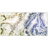 Immunohistochemistry - Anti-Histone H3 (acetyl Lys18) Antibody (D0008) - Antibodies.com