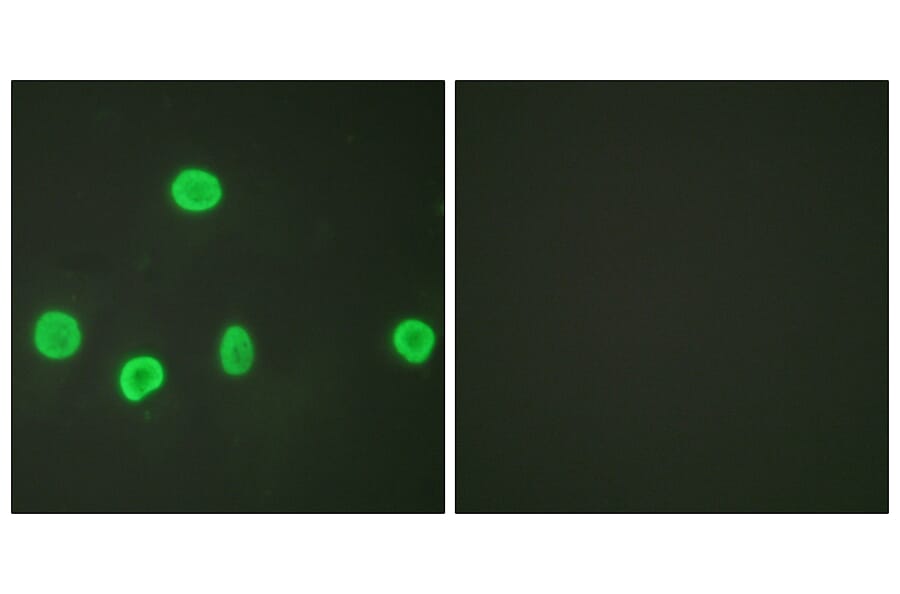 Immunofluorescence - Anti-Histone H3 (acetyl Lys18) Antibody (D0008) - Antibodies.com