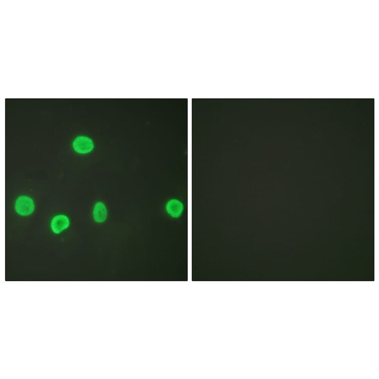 Immunofluorescence - Anti-Histone H3 (acetyl Lys18) Antibody (D0008) - Antibodies.com