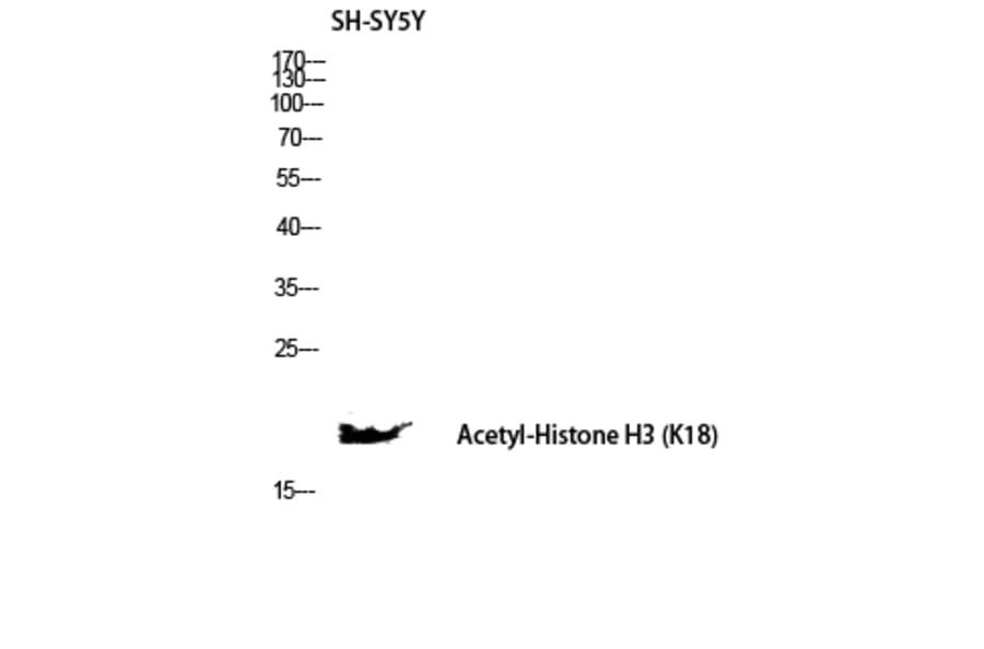 Western Blot - Anti-Histone H3 (acetyl Lys18) Antibody (D0008) - Antibodies.com