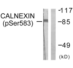 Western Blot - Anti-Calnexin (phospho Ser583) Antibody (A0463) - Antibodies.com