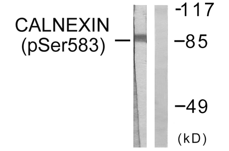 Western Blot - Anti-Calnexin (phospho Ser583) Antibody (A0463) - Antibodies.com