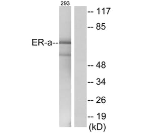 Western Blot - Anti-Estrogen Receptor-alpha Antibody (B0476) - Antibodies.com