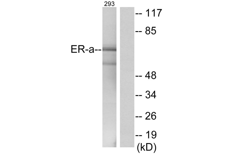 Western Blot - Anti-Estrogen Receptor-alpha Antibody (B0476) - Antibodies.com