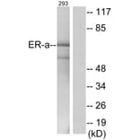 Western Blot - Anti-Estrogen Receptor-alpha Antibody (B0476) - Antibodies.com