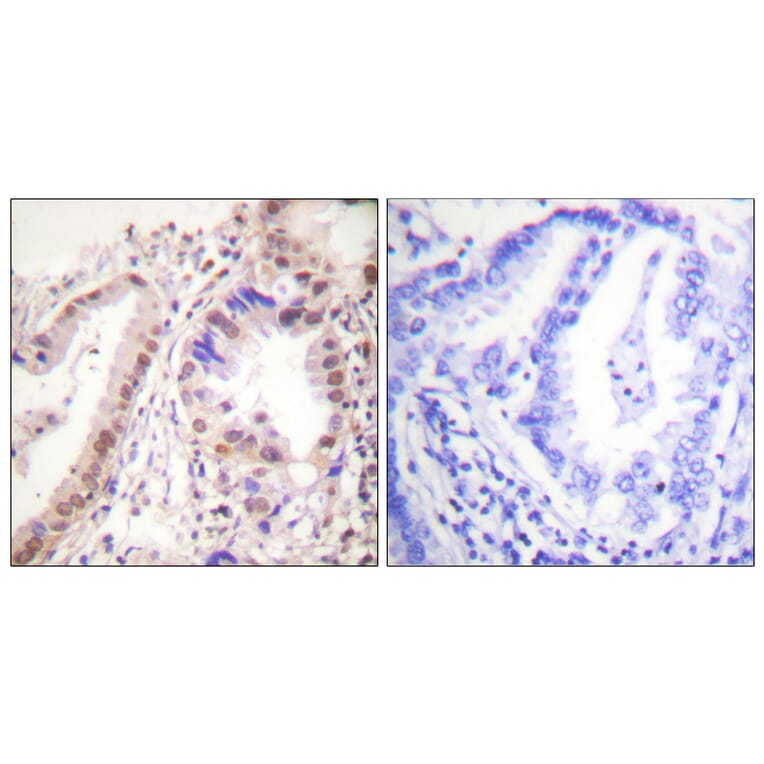 Immunohistochemistry - Anti-Estrogen Receptor-alpha Antibody (B0476) - Antibodies.com