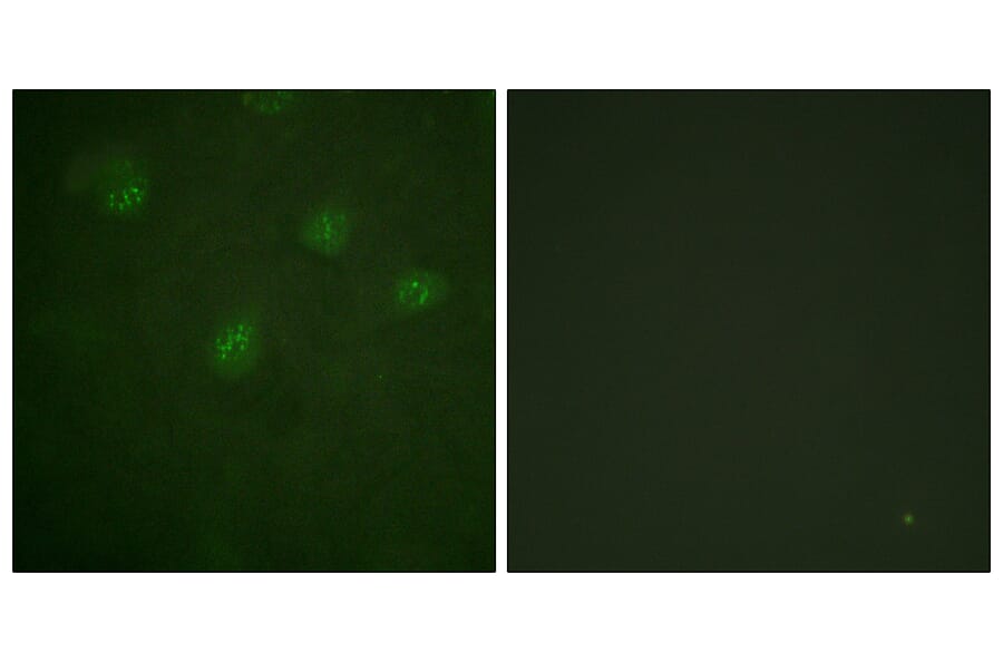 Immunofluorescence - Anti-Estrogen Receptor-alpha Antibody (B0476) - Antibodies.com