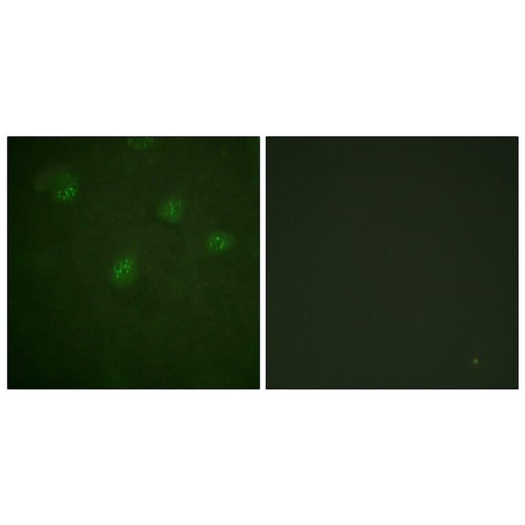 Immunofluorescence - Anti-Estrogen Receptor-alpha Antibody (B0476) - Antibodies.com