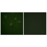 Immunofluorescence - Anti-Estrogen Receptor-alpha Antibody (B0476) - Antibodies.com