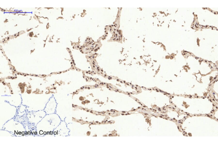 Immunohistochemistry - Anti-Estrogen Receptor-alpha Antibody (B0476) - Antibodies.com