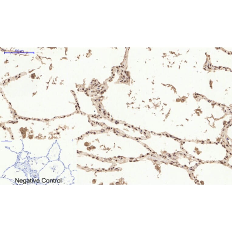 Immunohistochemistry - Anti-Estrogen Receptor-alpha Antibody (B0476) - Antibodies.com