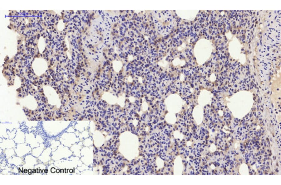 Immunohistochemistry - Anti-Estrogen Receptor-alpha Antibody (B0476) - Antibodies.com