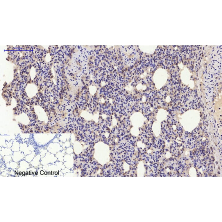 Immunohistochemistry - Anti-Estrogen Receptor-alpha Antibody (B0476) - Antibodies.com