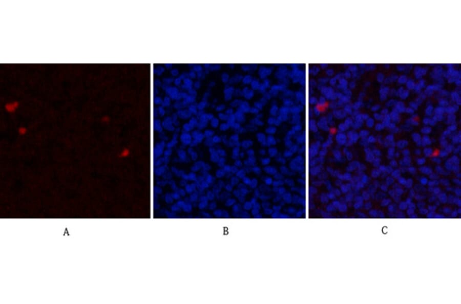 Immunofluorescence - Anti-Estrogen Receptor-alpha Antibody (B0476) - Antibodies.com
