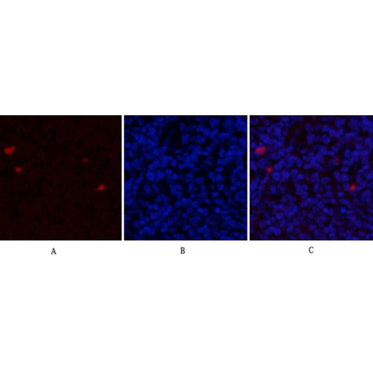 Immunofluorescence - Anti-Estrogen Receptor-alpha Antibody (B0476) - Antibodies.com