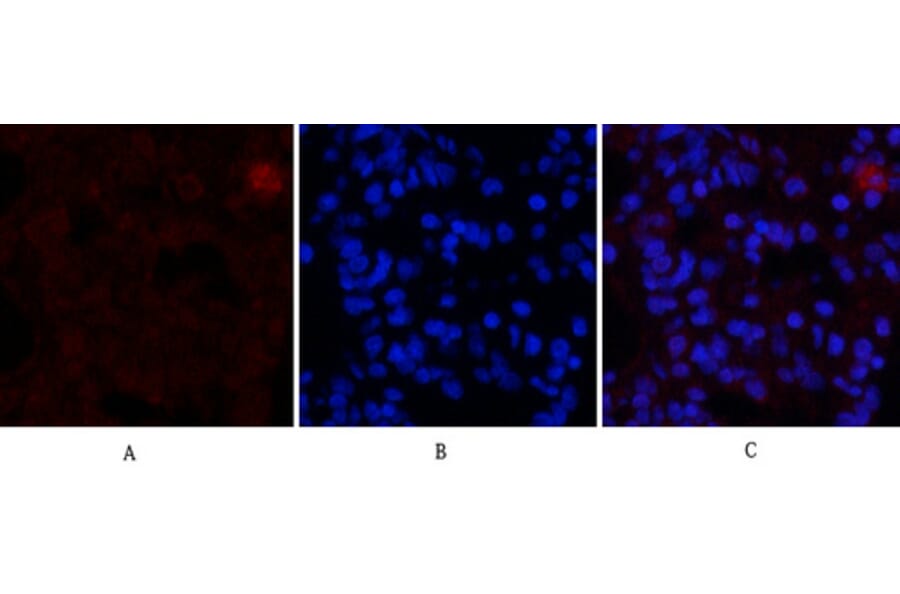 Immunofluorescence - Anti-Estrogen Receptor-alpha Antibody (B0476) - Antibodies.com