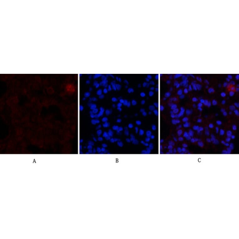 Immunofluorescence - Anti-Estrogen Receptor-alpha Antibody (B0476) - Antibodies.com