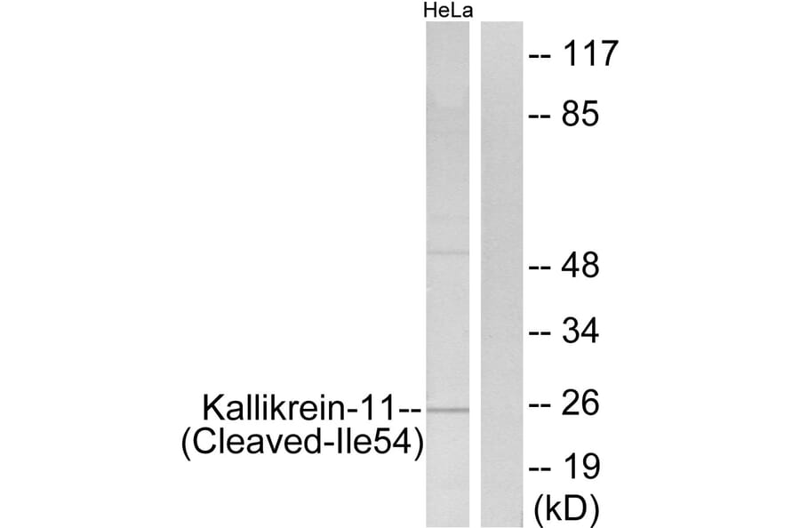 Western Blot - Anti-Kallikrein-11 (cleaved Ile54) Antibody (L0303) - Antibodies.com