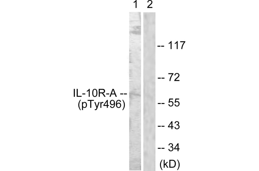 Western Blot - Anti-IL-10R alpha (phospho Tyr496) Antibody (A1056) - Antibodies.com