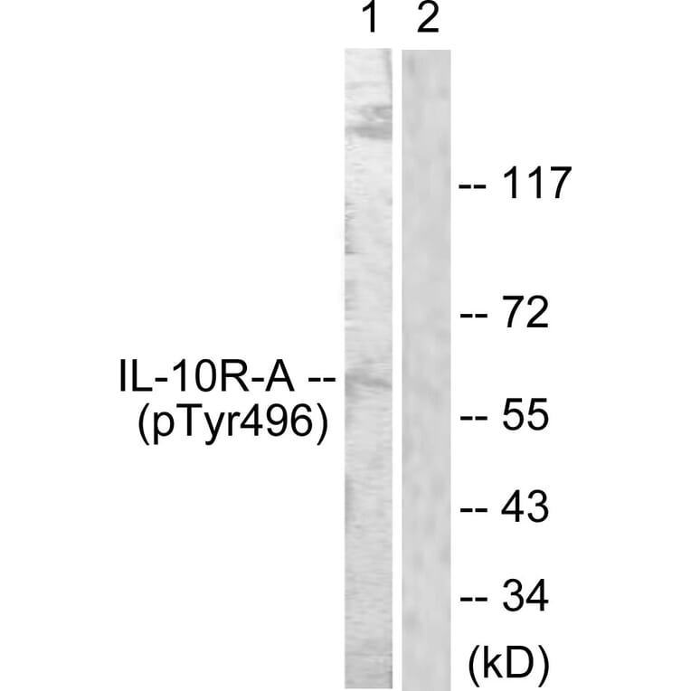 Western Blot - Anti-IL-10R alpha (phospho Tyr496) Antibody (A1056) - Antibodies.com