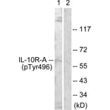 Western Blot - Anti-IL-10R alpha (phospho Tyr496) Antibody (A1056) - Antibodies.com