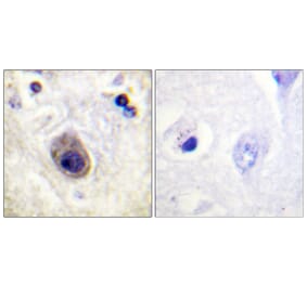 Immunohistochemistry - Anti-Connexin 43 (phospho Ser261) Antibody (A0874) - Antibodies.com