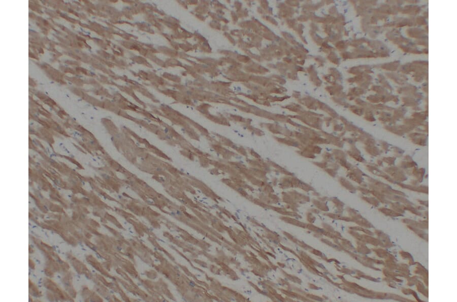 Immunohistochemistry - Anti-alpha cardiac muscle Actin Antibody (V0003) - Antibodies.com
