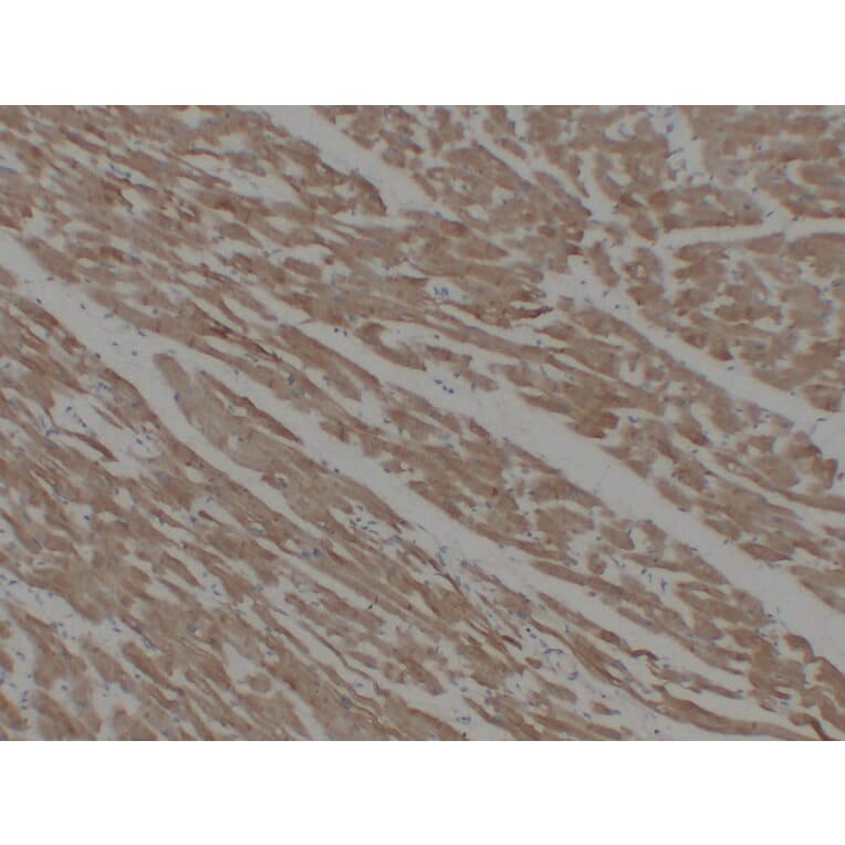 Immunohistochemistry - Anti-alpha cardiac muscle Actin Antibody (V0003) - Antibodies.com