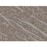 Immunohistochemistry - Anti-alpha cardiac muscle Actin Antibody (V0003) - Antibodies.com