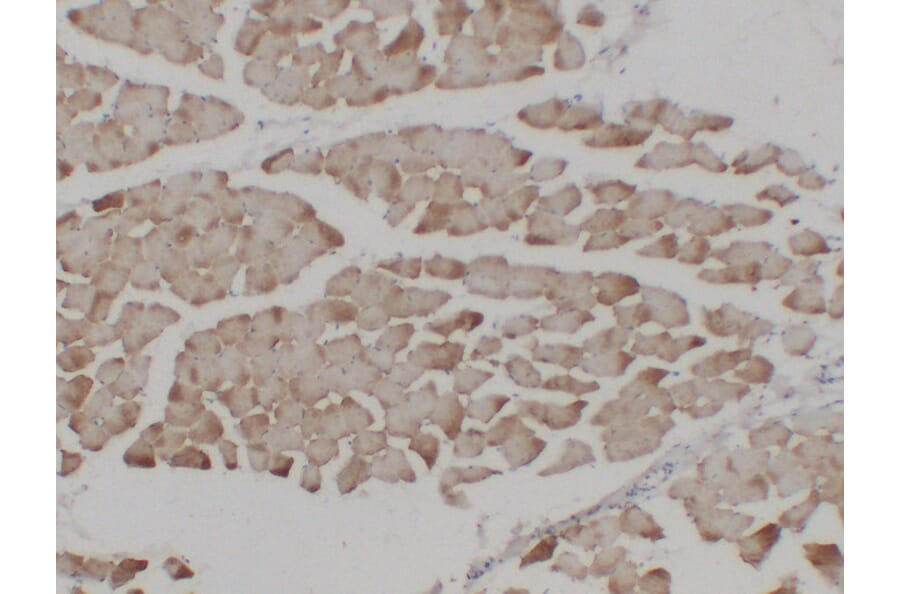 Immunohistochemistry - Anti-alpha cardiac muscle Actin Antibody (V0003) - Antibodies.com