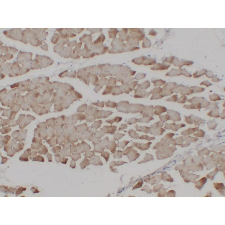 Immunohistochemistry - Anti-alpha cardiac muscle Actin Antibody (V0003) - Antibodies.com