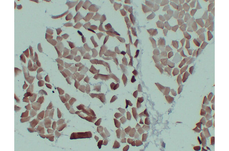 Immunohistochemistry - Anti-alpha cardiac muscle Actin Antibody (V0003) - Antibodies.com