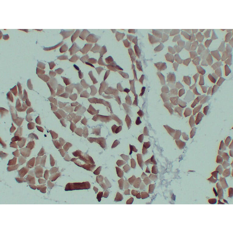 Immunohistochemistry - Anti-alpha cardiac muscle Actin Antibody (V0003) - Antibodies.com