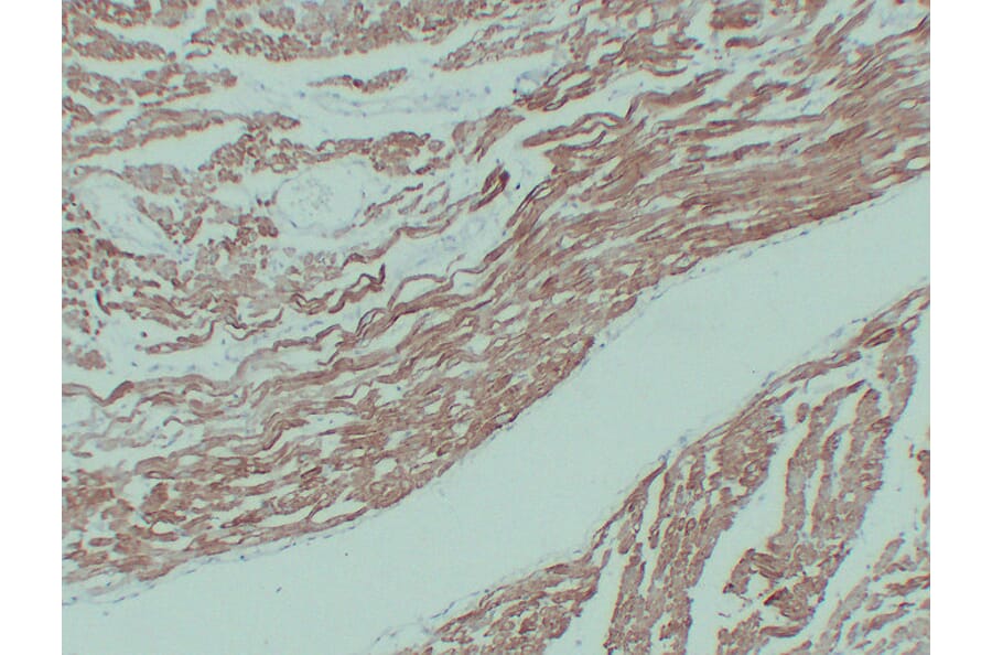 Immunohistochemistry - Anti-alpha cardiac muscle Actin Antibody (V0003) - Antibodies.com
