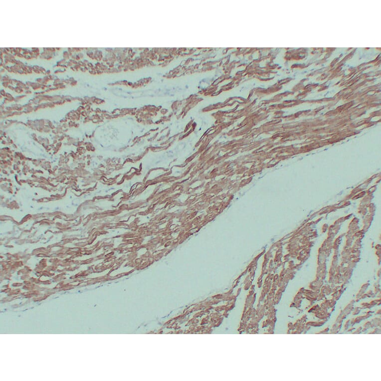 Immunohistochemistry - Anti-alpha cardiac muscle Actin Antibody (V0003) - Antibodies.com