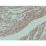 Immunohistochemistry - Anti-alpha cardiac muscle Actin Antibody (V0003) - Antibodies.com