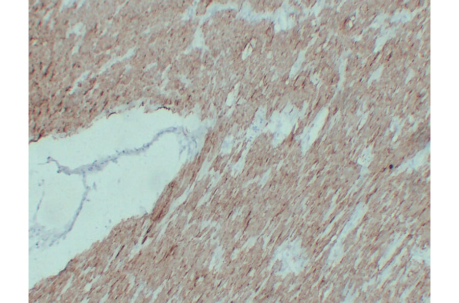 Immunohistochemistry - Anti-alpha cardiac muscle Actin Antibody (V0003) - Antibodies.com