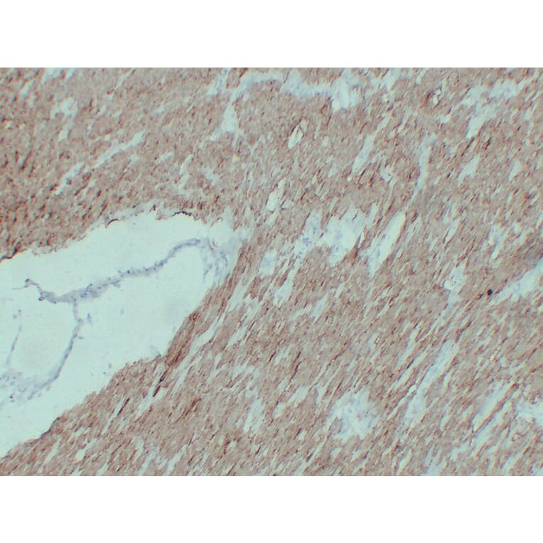 Immunohistochemistry - Anti-alpha cardiac muscle Actin Antibody (V0003) - Antibodies.com