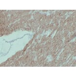 Immunohistochemistry - Anti-alpha cardiac muscle Actin Antibody (V0003) - Antibodies.com