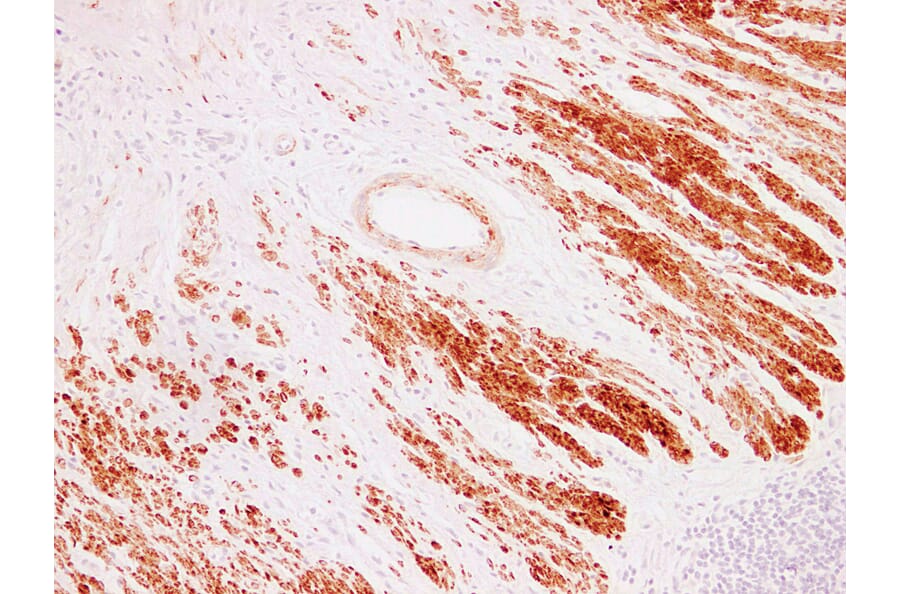 Immunohistochemistry - Anti-alpha cardiac muscle Actin Antibody (V0003) - Antibodies.com
