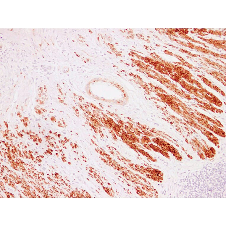 Immunohistochemistry - Anti-alpha cardiac muscle Actin Antibody (V0003) - Antibodies.com