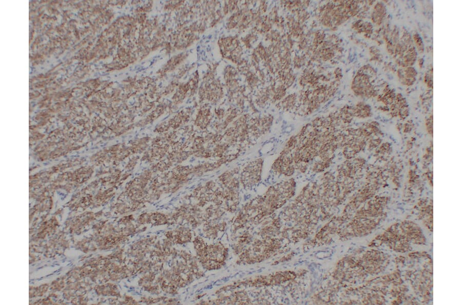 Immunohistochemistry - Anti-alpha cardiac muscle Actin Antibody (V0003) - Antibodies.com