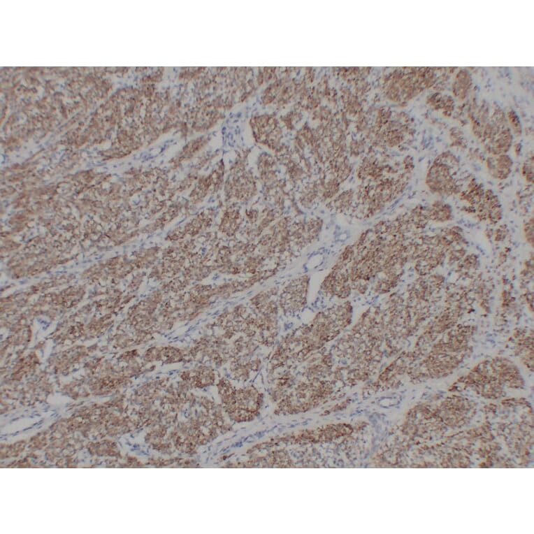 Immunohistochemistry - Anti-alpha cardiac muscle Actin Antibody (V0003) - Antibodies.com